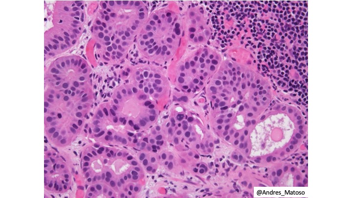 Andres Matoso tweet media