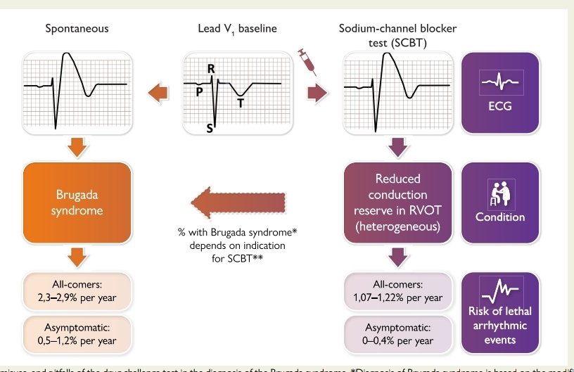 Martín Negreira (@negreiramartin) on Twitter photo ⚡TEST FARMACOLÓGICOS Y SÍNDROME DE BRUGADA🦈
🤓Aprovechando esta reciente (y excelente, yo creo) revisión de <a href="/ESC_Journals/">European Society of Cardiology Journals</a> creo que puede estar bien un mini🧵recordando algunos aspectos clave sobre este tema, que vemos cada vez ➕ frec. ⚡TEST FARMACOLÓGICOS Y SÍNDROME DE BRUGADA🦈
🤓Aprovechando esta reciente (y excelente, yo creo) revisión de <a href="/ESC_Journals/">European Society of Cardiology Journals</a> creo que puede estar bien un mini🧵recordando algunos aspectos clave sobre este tema, que vemos cada vez ➕ frec.