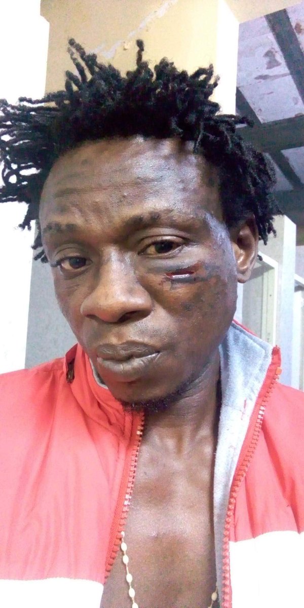 Shahina57828555's tweet image. #lampurdetentioncamp #Frro this guy is in lampur dentention camp since 2 years.he must be deported to his country,everyday stabbing ,fighting is going on in camp ,their life is at stake #ModiGovt,no money for flight ticket Indian govt should manage ticket for helpless guys