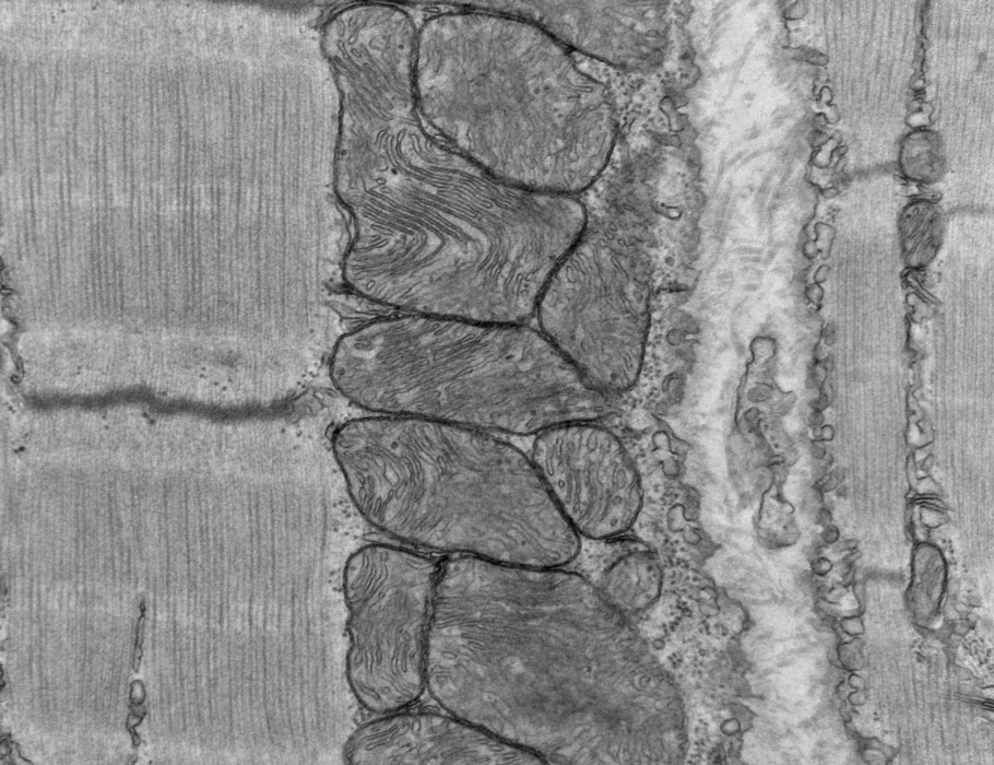 Science Immunology (@sciimmunology) on Twitter photo New work in mice found Treg cells in muscles rapidly expand following exercise—and, in mice without Treg cells, exercise led to overproduction of interferon‐gamma, impaired mitochondrial function, and reduced endurance. <a href="/KentLangston/">P. Kent Langston</a> <a href="/harvardmed/">Harvard Medical School</a>
📄: scim.ag/4Kt New work in mice found Treg cells in muscles rapidly expand following exercise—and, in mice without Treg cells, exercise led to overproduction of interferon‐gamma, impaired mitochondrial function, and reduced endurance. <a href="/KentLangston/">P. Kent Langston</a> <a href="/harvardmed/">Harvard Medical School</a>
📄: scim.ag/4Kt