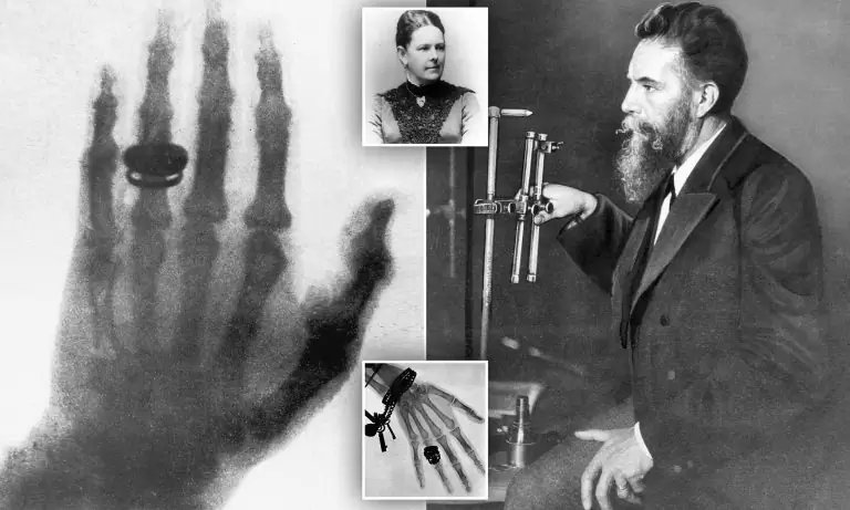 Feliz dia de la radiología Un día como hoy, hace 128 años, se adquirió la primera radiografía por parte del sr roentgen a su esposa. De ahí en adelante, se han desarrollado conocimientos y maquinarias qué nos han permitido explorar y ampliar nuestros conocimientos radiológicos