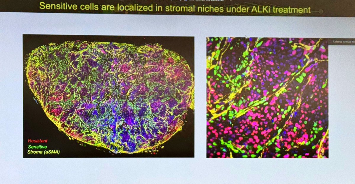 Next it’s friend, collaborator and @mathonco experimentalist extraordinaire @AndriyMarusyk presenting,  Impact of microenvironment on the acquisition of resistance to targeted therapies in lung cancers #CSBCPSON23 @MoffittNews