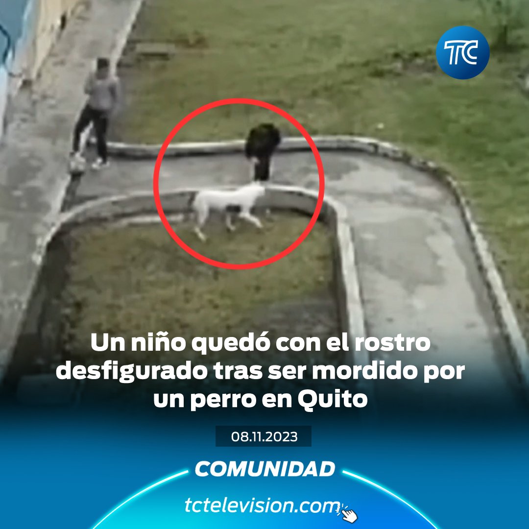 tctelevision's tweet photo. Cámaras registraron el ataque de un pitbull a un niño. El menor se le acercó al can para saludarlo y este respondió con una mordida en su rostro. » https://t.co/QllsXS0ESB https://t.co/QjCsv2Jvtt