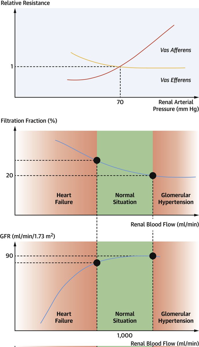 Diuretic Therapy for Patients With Heart Failure: #JACC State-of-the-Art Review
sciencedirect.com/science/articl…
#review #JACC #cardiology #CardioEd #cardiox #CardioTwitter #HF