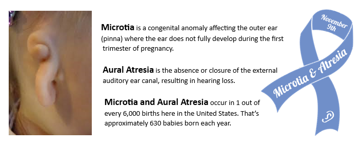 EarCommunityOrg's tweet photo. TOMORROW, NOVEMBER 9TH is National Microtia and Atresia Awareness Day!

We are ready to embrace our special day! 👂💙
#Nationalmicrotiaandatresiaawarenessday
#microtiakidsrock
#EarCommunity https://t.co/HBCV5xQNOU