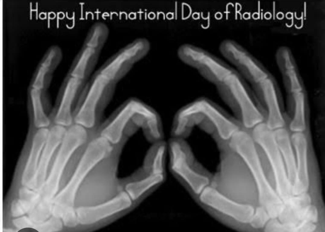 Feli_M (@feli_maina) on Twitter photo Super fun day at KNH today celebrating the International Day of Radiology. I am a proud member of this wonderful team! Ensuring patient safety beyond radiation protection.
#happyinternationaldayofradiology
#PatientSafety
#interventionalradiology
<a href="/KNH_hospital/">Kenyatta National Hospital</a> Super fun day at KNH today celebrating the International Day of Radiology. I am a proud member of this wonderful team! Ensuring patient safety beyond radiation protection.
#happyinternationaldayofradiology
#PatientSafety
#interventionalradiology
<a href="/KNH_hospital/">Kenyatta National Hospital</a>