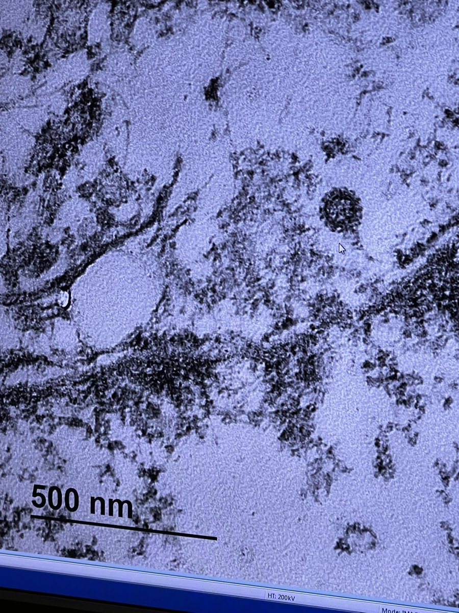 A_AbeerRA's tweet photo. Happy International Pathology Day 🔬🥼💖
#Corona_virus #Electron_microscope #Ultrastructure_details #natural_heart #light_microscope https://t.co/4EjYSbxxrt