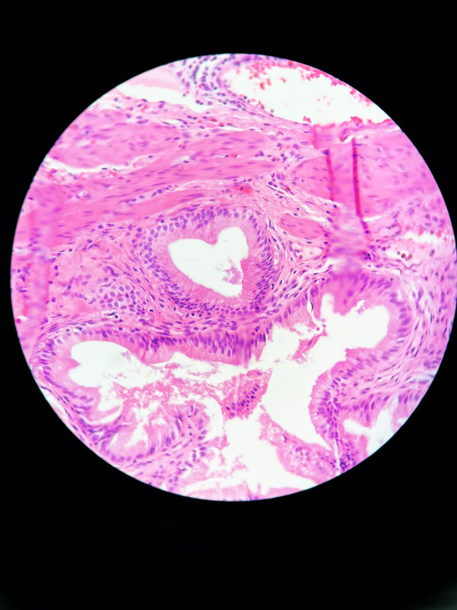 A_AbeerRA's tweet photo. Happy International Pathology Day 🔬🥼💖
#Corona_virus #Electron_microscope #Ultrastructure_details #natural_heart #light_microscope https://t.co/4EjYSbxxrt