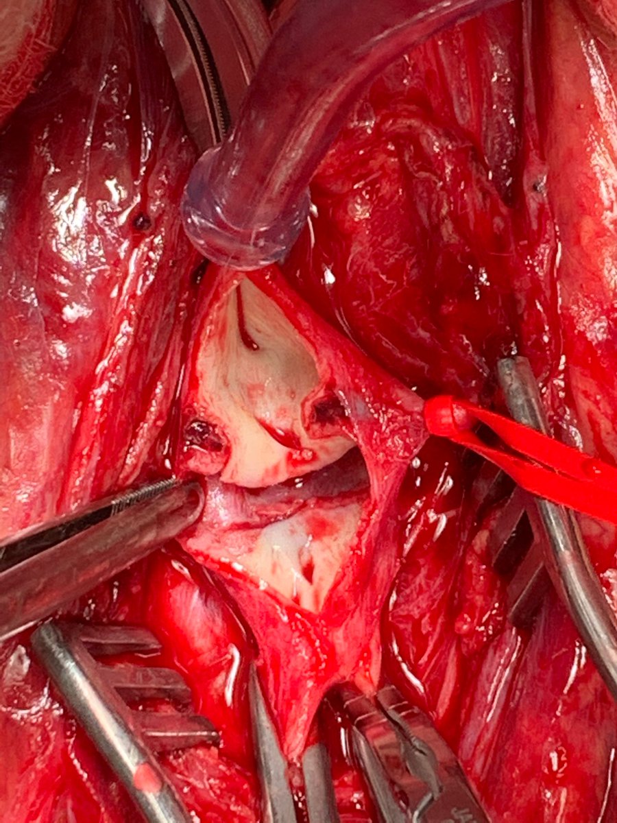 Omamah Almousa MD MSc RPVI FRCSC FACS tweet media