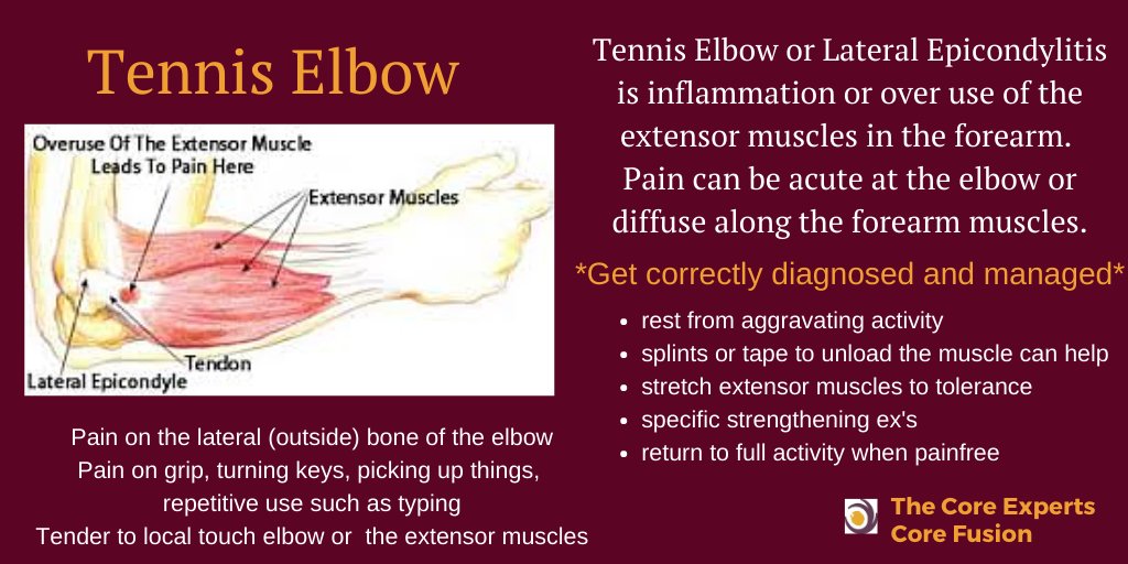 Tennis Elbow is pain on the outside bone of the elbow ( extensor muscles)
Causes pain with gripping,  lifting, turning keys. holding and carrying bags, opening jars or lids to name a few.

We have a free 5 day info series - sign up 

xg204.infusionsoft.app/app/form/tenni…

#tenniselbow  #physio