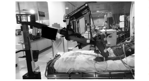 ArtifOrgans's tweet photo. #Functional #ElectricalStimulation cycling-based muscular evaluation method in #MechanicallyVentilated patients
@Ufpeoficial🇧🇷| #FESCycling #Weakness https://t.co/fhlbICT3cW