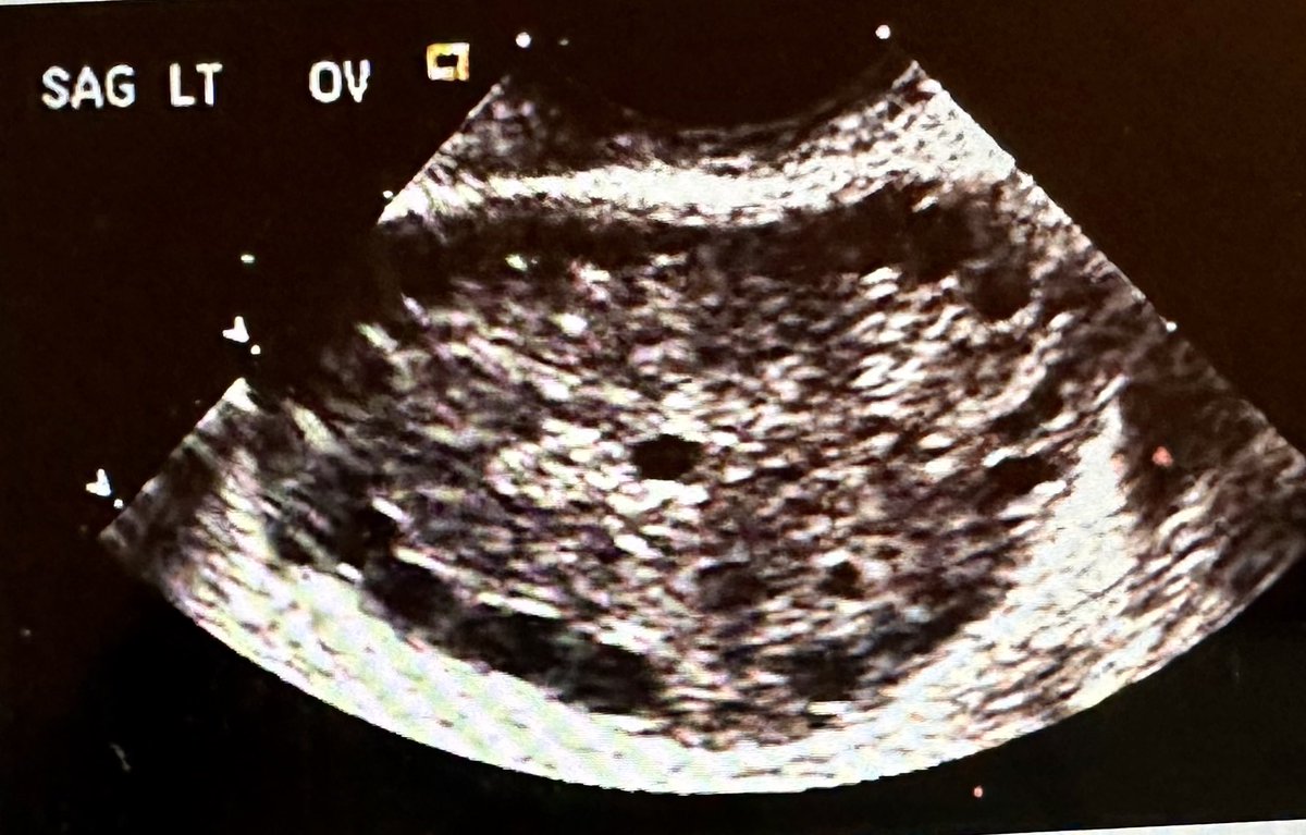 Anuja Dokras, MD MHCI PhD tweet media