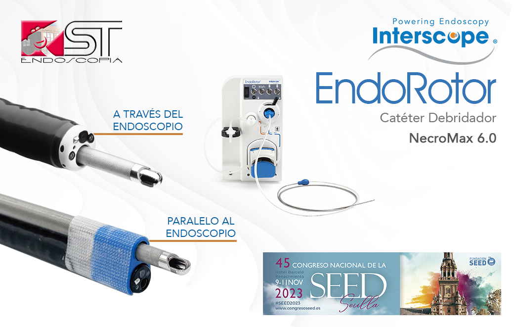 Seguro que algunos de vosotros ya conocéis el Debridador Endoscopico Motorizado #Endorotor de <a href="/InterscopeMed/">Interscope Inc. (EndoRotor®)</a>, pero posiblemente no conozcáis las últimas novedades que lo acompañan.

Ahora con el Catéter Debridador 𝗡𝗲𝗰𝗿𝗼𝗠𝗮𝘅 𝟲.𝟬 podrás obtener 8 veces mayor rendimiento