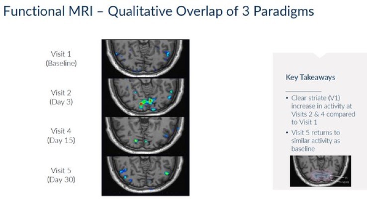 Canal_Retina's tweet photo. Kiora demuestra mejoras significativas en la visión en pacientes ciegos con retinosis pigmentaria

Los primeros resultados en humanos  reflejan una mejora significativa en el campo visual, en concordancia  con las ...

https://t.co/bj1aQnr9br https://t.co/Y7bIq79SwQ