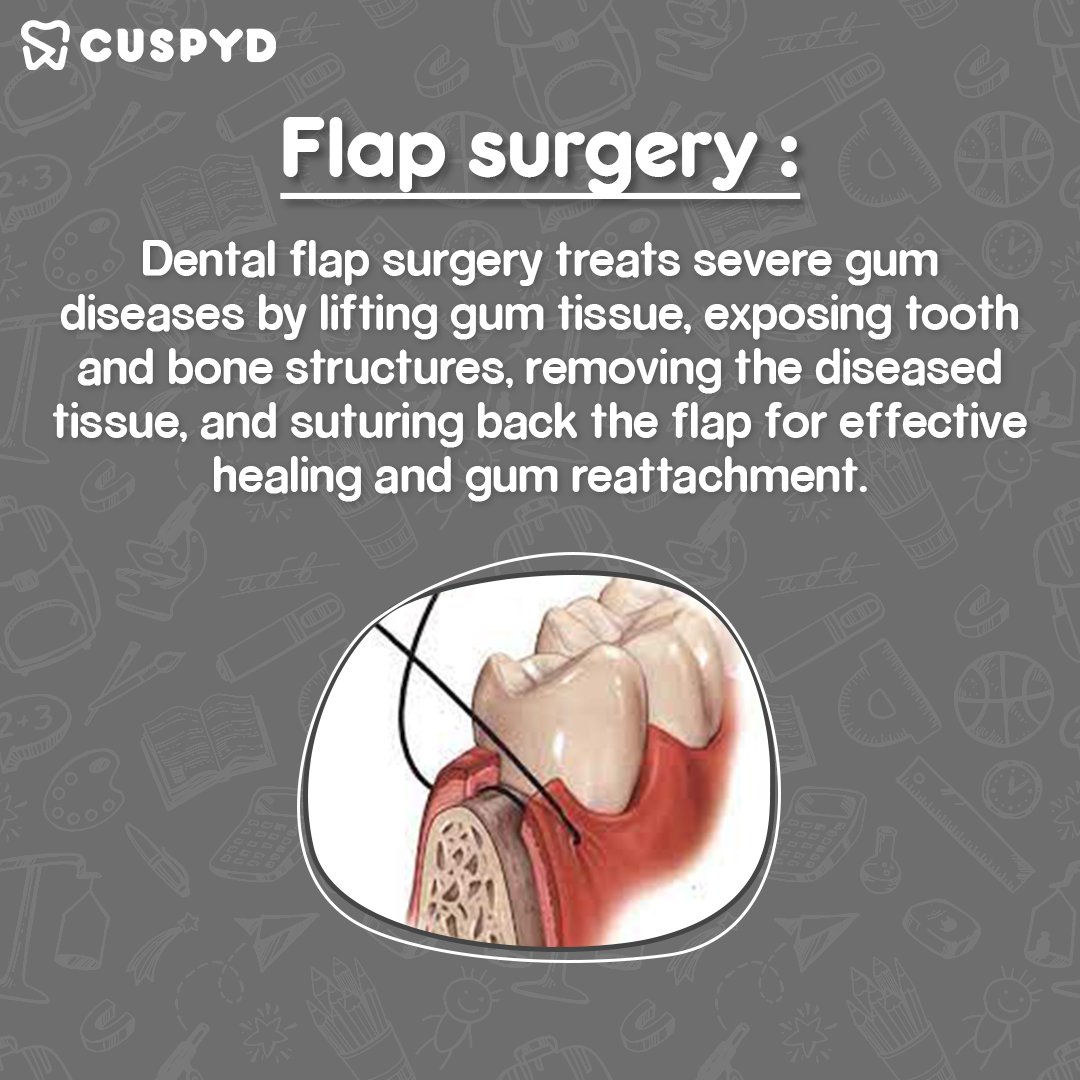 cuspyd_dental's tweet photo. "ABCs of Dentistry". 
Today starting with the letter 🌟#F
for your weekly dose of dental #terminologies &amp; their #meanings 
Follow @cuspyd_dental

 #easyunderstanding #learn #dentistry #easylearning #Dental #dentalterminology #studytwt #KnowBeforeYouGo https://t.co/iIzCtgH3oe