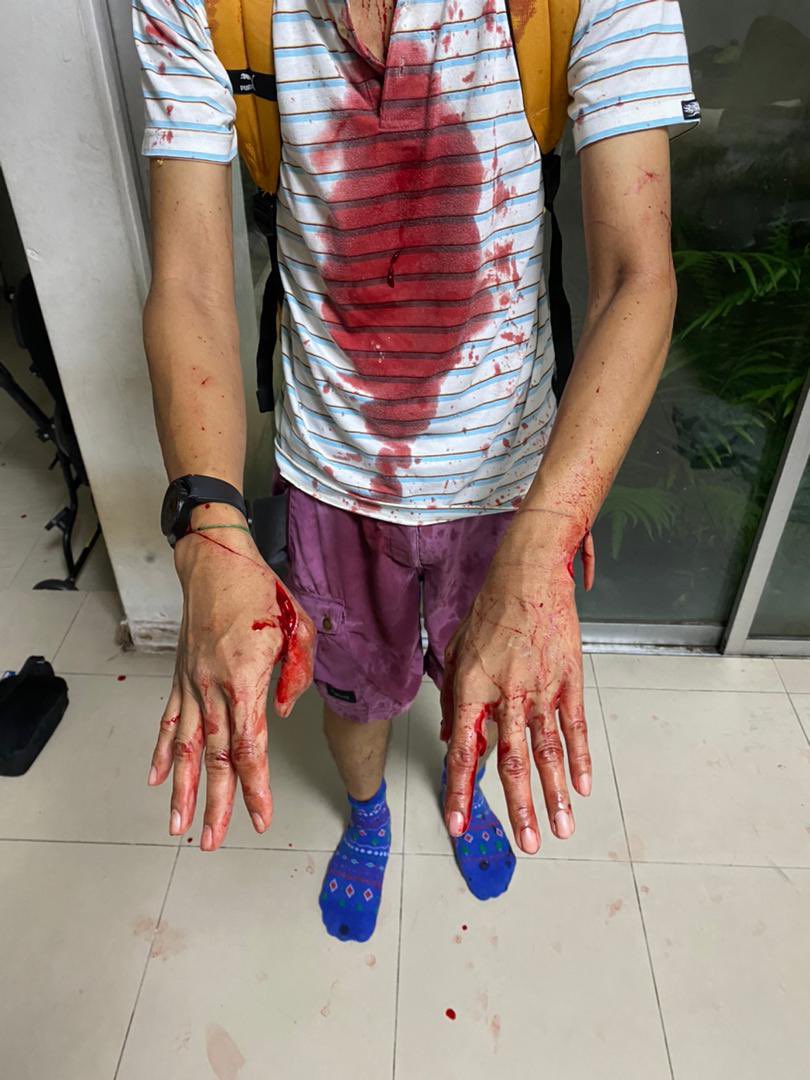ZaraaZameen's tweet photo. Hati hati warga Shah Alam yang suka jogging sorang sorang waktu pagi! Kawasan rumah aku Seksyen 27 ada yang kena kelar time jogging pukul 6pagi sebab ada orang nak rompak. 😰 HATI HATI ESPECIALLY PEREMPUAN! Yang ni lelaki pun kena. Kalau perempuan tak tahu lah 😥😥 https://t.co/LSkoToxxip