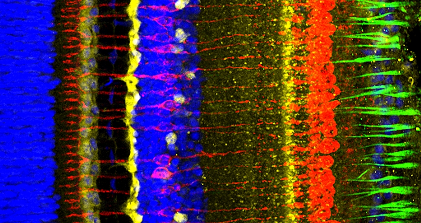 Empa_CH's tweet image. 2 innovative Empa projects supported by #HeinzOertli-Fonds:
- New therapeutic options for #glaucoma: the eye treats itself without medical assistance
- Protection of #eyetissue during operations thx to laser-based adhesive procedure
▶fcld.ly/581xlpi
#EmpaZukunftsfonds