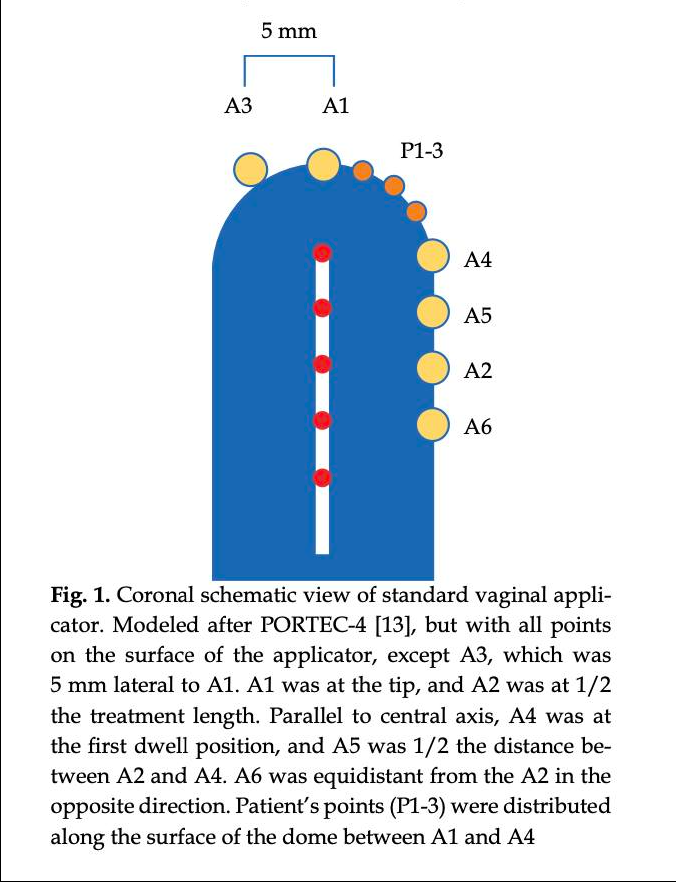 In treatment planning for high-dose-rate (HDR) single-channel vaginal cylinder brachytherapy, the dose distribution along the cylinder is invariably influenced by the anisotropy of the source.
termedia.pl/Dosimetric-com…
