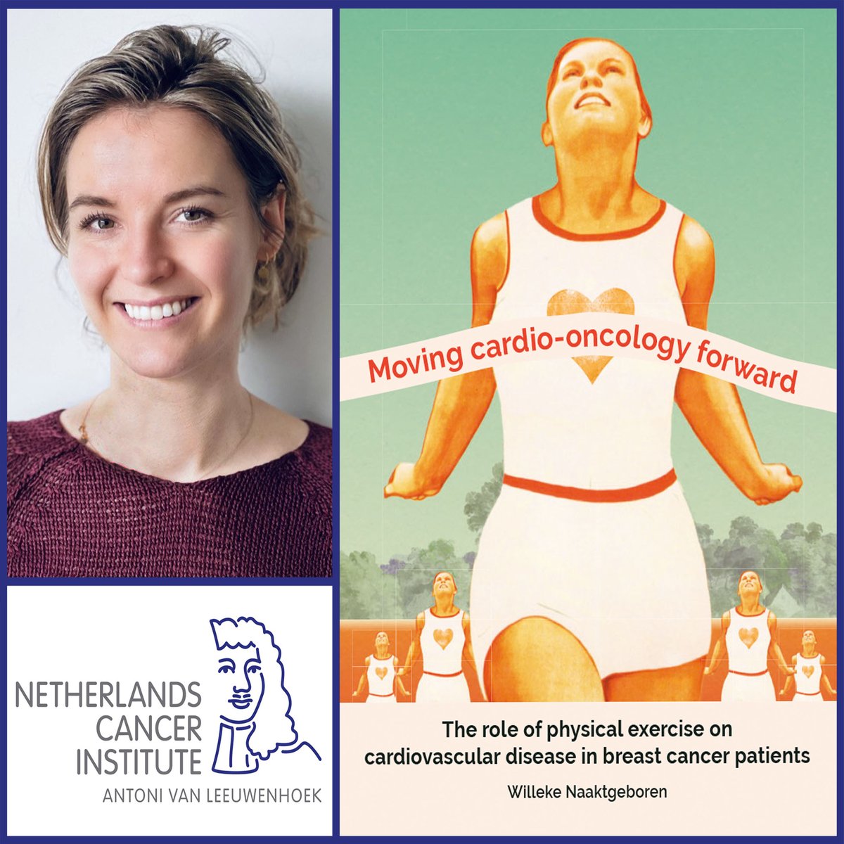 Breast cancer patients who engaged in intensive physical activity during their treatment may experience less cardiovascular damage, PhD candidate Willeke Naaktgeboren found. She successfully defended her thesis on October 24. @hetAVL @uniutrecht @spaarnegasthuis