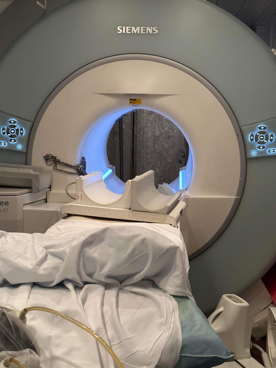 Shackled prisoner brought in for an MRI. Shackles were removed, but CO carried them into the room (leg shackles in one hand, belly chain in the other). Restraints in one hand of the CO flew. Tech stopped the CO (with a set in the other hand) from advancing further. 

#MRIsafety