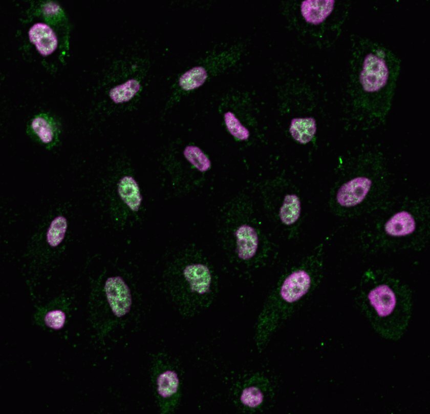 Hubrecht Institute (@_hubrecht) on Twitter photo Researchers from the group of @FMattiroli developed a new fluorescence-based assay and used this to identify ANP32B as the histone chaperone responsible for the histone macroH2A. First author <a href="/IMandemaker/">Imke Mandemaker</a> tells all about it here! hubrecht.eu/histones-and-c… Researchers from the group of @FMattiroli developed a new fluorescence-based assay and used this to identify ANP32B as the histone chaperone responsible for the histone macroH2A. First author <a href="/IMandemaker/">Imke Mandemaker</a> tells all about it here! hubrecht.eu/histones-and-c…