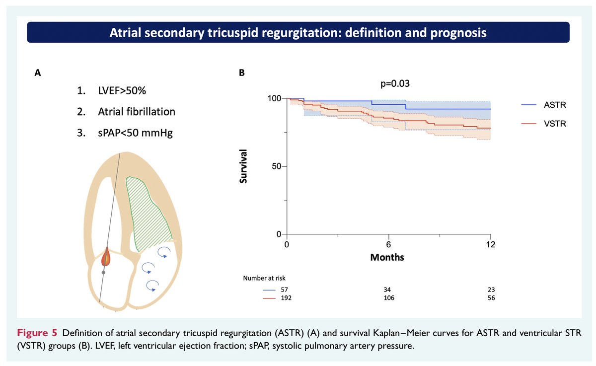 Not all Secondary TR are born equal!Atrial vs Ventricular Secondary TR finally out on #EJHF!Great collaborative effort from all #TriValve Investigators! @m_taramasso @MarcoMetra @lpbadano @drmaisano @MariannaAdamo1 @FabienPraz @RodrigoEstvez1 @azeemlatib @PhilippLurz @GilbertTang