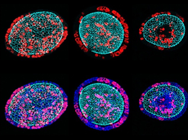 BPoD_s's tweet image. #Organoids grown on hydrogel with tuneable mechanical properties reveal #extracellularmatrix forces in guiding formation of sensory #epithelium. Image & research by Mingyu Xia, Mingxuan Wu & Yuanrong Li et al @FudanUniv @ZJU_China in @ScienceAdvances. On bpod.org.uk/archive/2023/1…