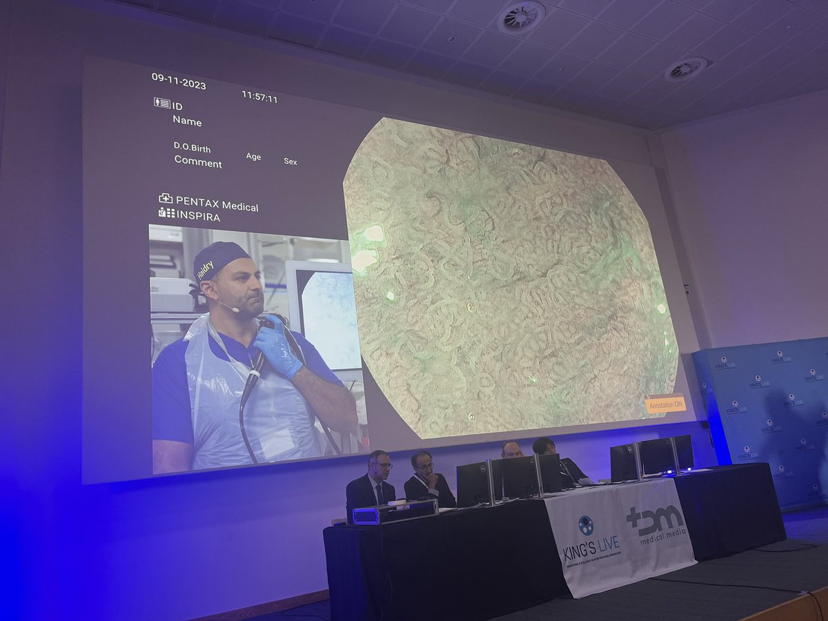 idris_PENTAXMed's tweet photo. Another demonstration of the power of #PENTAXMedical #INSPIRA™ improved imaging even with our legacy magniview endoscopes for Barrett’s. Thanks @rehan_haidry #KingsLive2023 https://t.co/yhiQBSt9gi