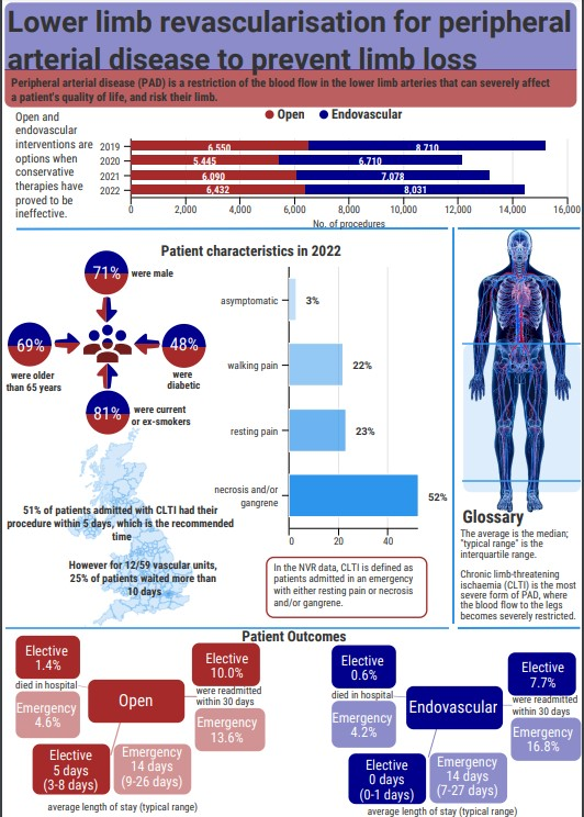 PodVascSAG's tweet photo. National Vascular Registry state of the nation report 2023  inforhraphics for patients with peripheral arterial disease (PAD) who undergo either (a) lower limb angioplasty/stent, (b) lower limb bypass surgery, or (c) lower limb amputation 1/2 https://t.co/I2xGruSwpB