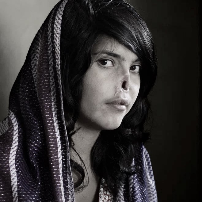 shipper_huipper's tweet image. «Не лезьте в их традиции!»

Это Аиша Мохаммадзай. Многие из вас видели это фото, но не все знают историю девушки. 

Когда ей было 12 лет, родственники-мужчины выдали ее замуж за взрослого мужика-талиба. 

С тех пор и начался личный ад девочки.