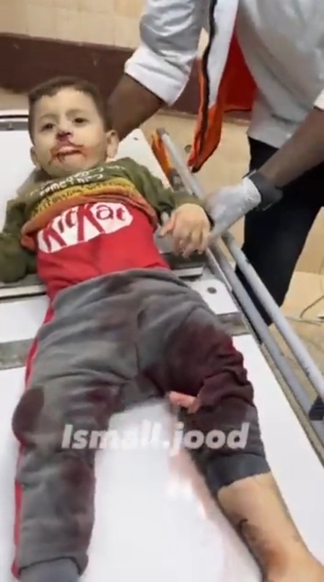 fitkah6's tweet photo. طفل فلسطيني يرتدي قميص كتب عليه "Kit Kat" نفس هذه الشركة هي من تسببت بكسر رجله لذلك #قاطعوا_كيت_كات #KitKat #kit_kat #كيت_كات #غزه_تباد_ومصر_تحتفل #غزه_تقاوم_وستنتصر #غزه_تباد_بدعم_اماراتي #فلسطين_تنتصر #غزة_تزحف_الى_القدس https://t.co/aiCgrKhsPq