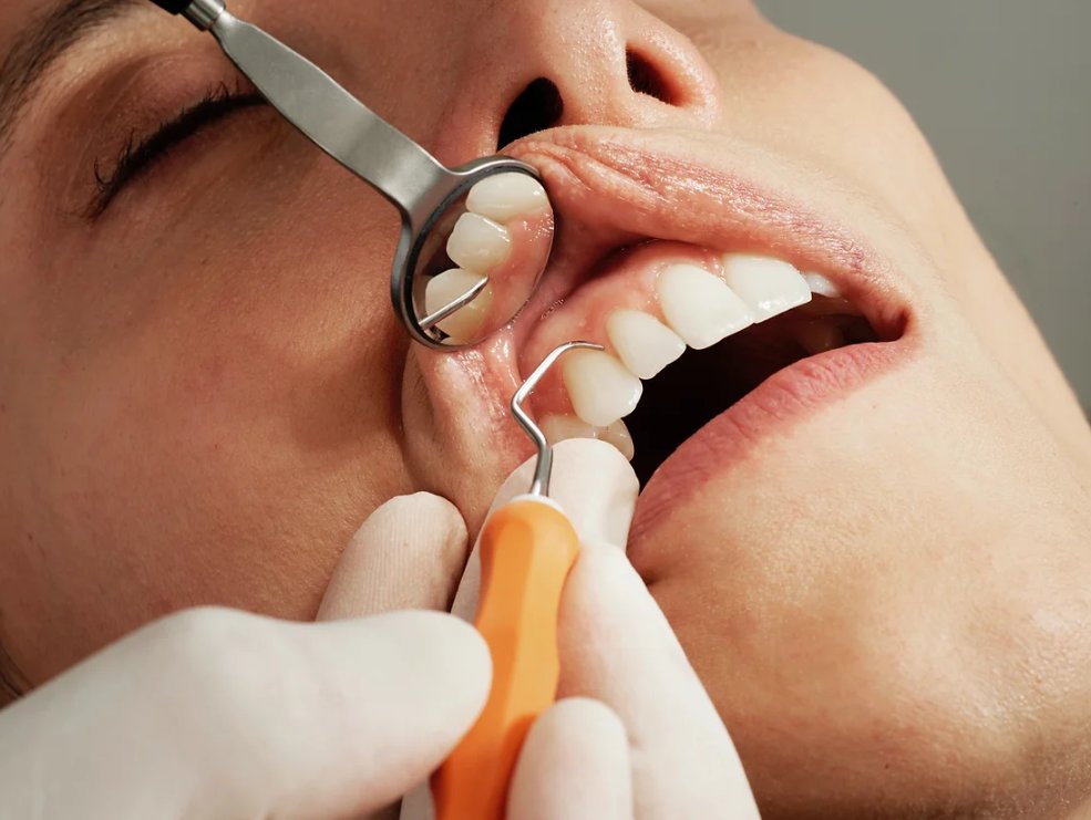 It was recently reported by the BBC that mouth cancer is increasing due to not being detected through regular dental check ups and access to NHS dentists.  All of our plans include dental check-ups.
getdentalplans.co.uk/post/increase-…
#dentalinsurance #mouthcancer #dentalcare