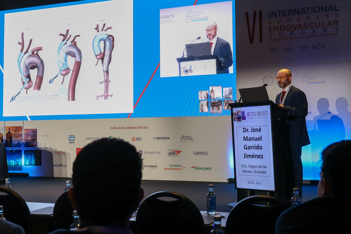 "En la actualidad no existen ensayos clínicos aleatorizados disponibles para fundamentar las decisiones sobre las ventajas y desventajas de cirugía híbrida en comparación con la cirugía abierta bajo CEC para el tto de los Aneurismas de Arco Aórtico"
🗣️Dr. Garrido <a href="/hospital_hvn/">HUVN</a>