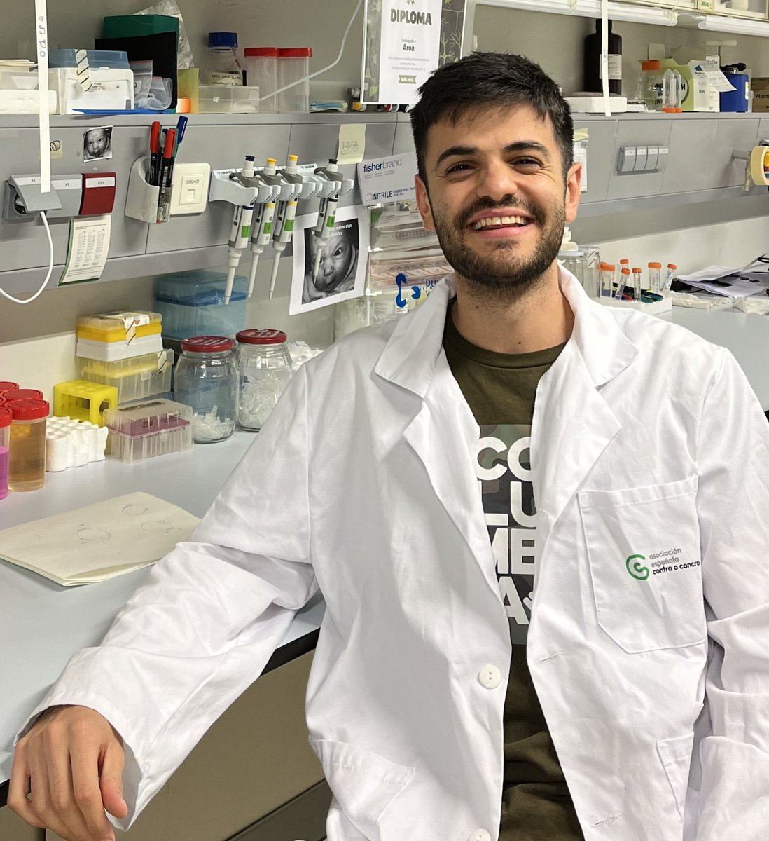 Alberto Tinahones trabaja sobre el colangiocarcinoma, un tipo de cáncer hepático, en el grupo Gene Regulatory Control in Disease del CiMUS. Estudian ARNs no codificantes y los estudios preliminares in vitro demuestran que al inhibirlos las células tumorales tienden a morir.