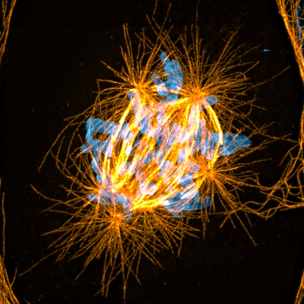 reuben_phi's tweet image. Previous submissions to @NikonSmallWorld. Dividing with too many centrosomes! #FluorescenceFriday #Centrosome