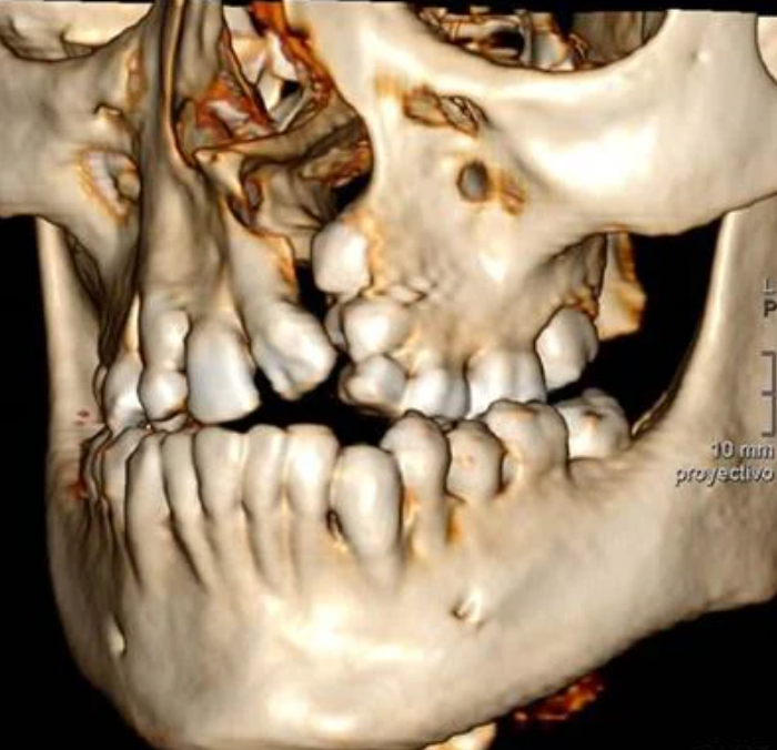 UC Davis Health Otolaryngology (@UCDavis_OTOHNS) / Posts / X