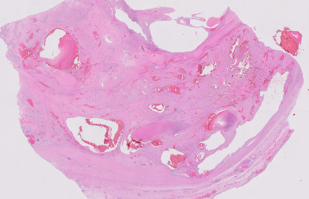 Katrina Collins, MD || Pathologist tweet media