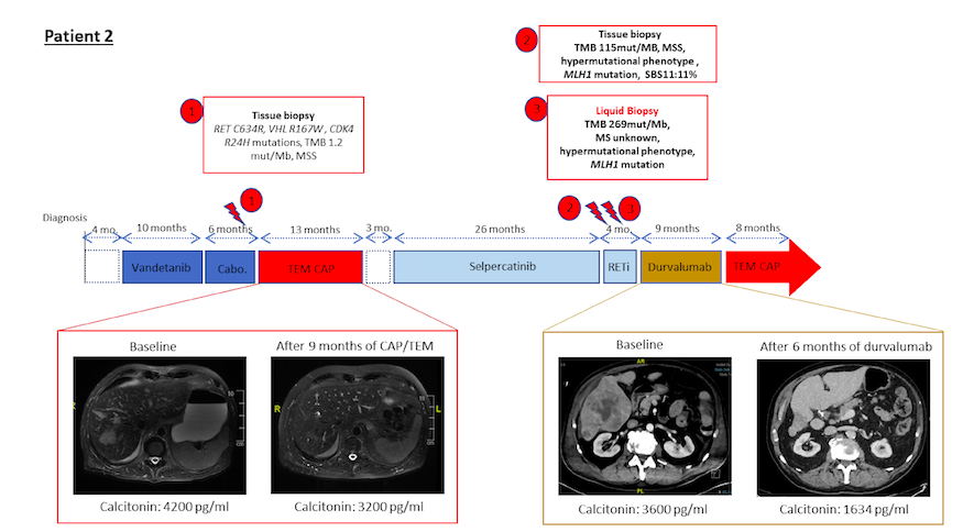 Hypermutant phenotype after alkylating agent treatment in 2 patients with MTC who responded to immunotherapy. @thyroidjournal @GustaveRoussy 
👉Don't forget to check TMB after alkylant
doi.org/10.1089/thy.20…