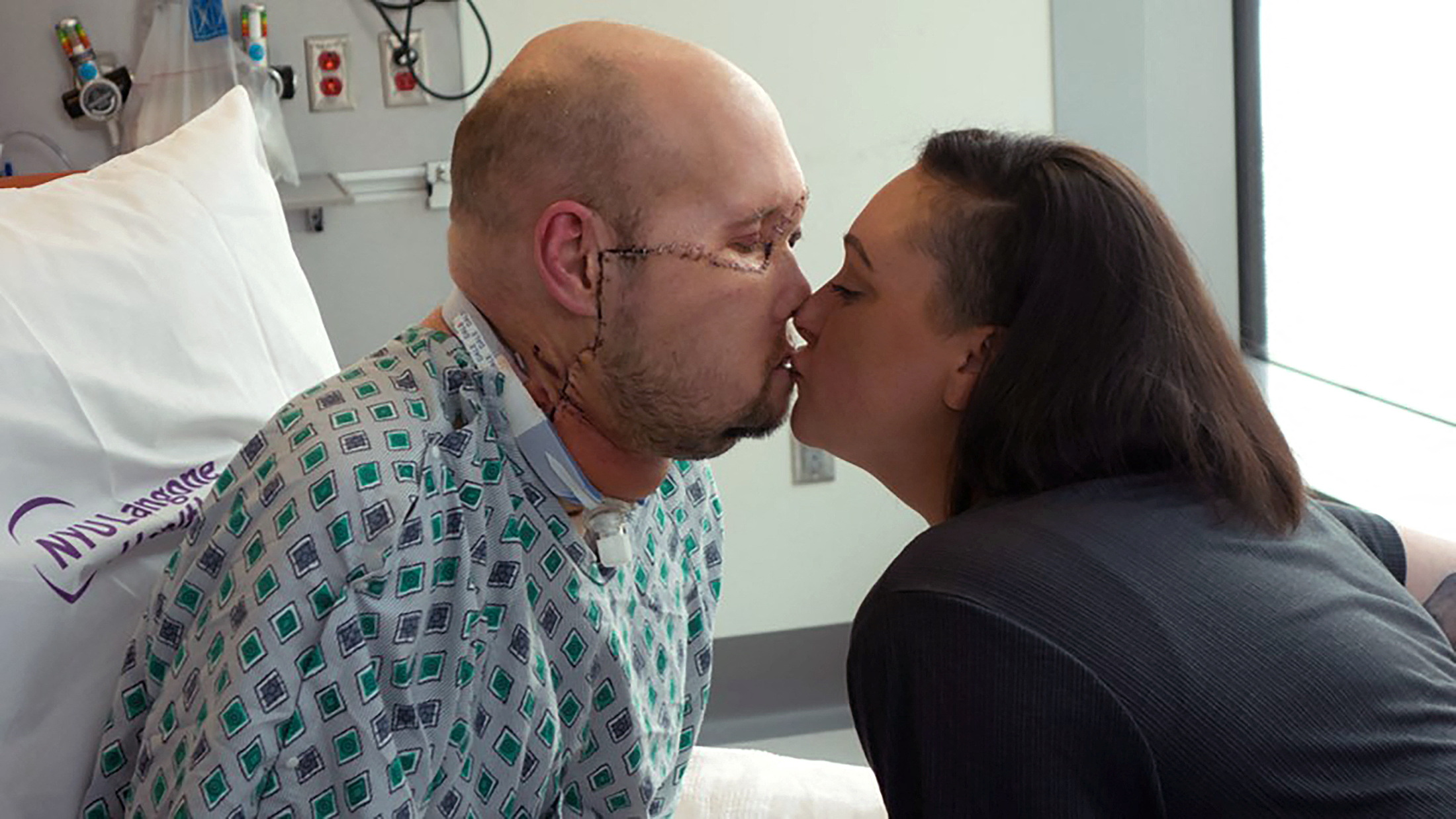 N+ Media on X: "En #NuevaYork, cirujanos lograron el primer trasplante de  ojo completo en un ser humano. El paciente fue Aaron James, un veterano  militar de 46 años de #Arkansas quien