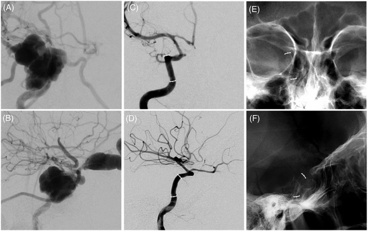 Juan Carlos Martinez Gutierrez MD tweet media
