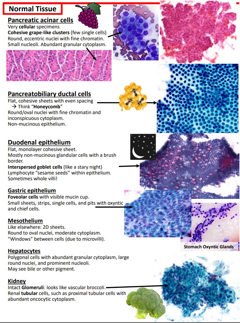 KurtSchaberg's tweet photo. I finished my notes on Pancreatobiliary cytology, incorporating the new WHO system, for my teaching website "Kurt's Notes" (https://t.co/OKmaPvGQpJ).

🔬🔬🔬🔬🔬🔬🔬🔬🔬🔬🔬🔬🔬🔬🔬🔬🔬🔬🔬🔬🔬🔬🔬🔬🔬🔬🔬🔬🔬🔬🔬🔬

Full notes available here: https://t.co/3qpWgerly3 https://t.co/g2zwP8XFOp