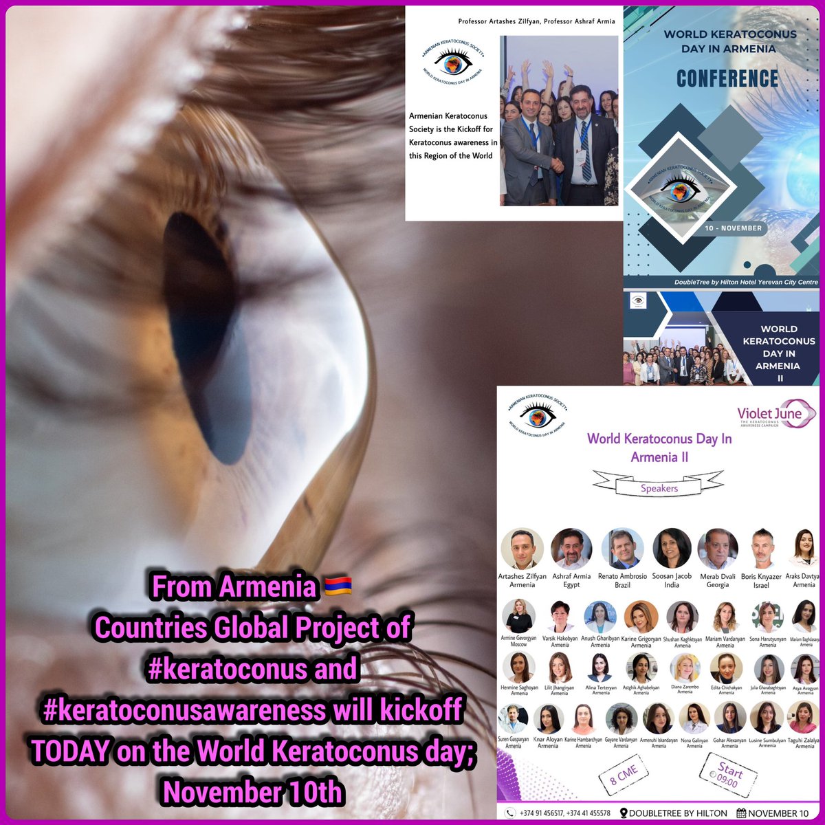 🤩 Global Announcement 📣 !!!
In less than an hour, KICKOFF of this Huge #keratoconus and #keratoconusawareness from #armenia 🇦🇲 !!! 
<a href="/GoHealio/">Healio</a> <a href="/Healio_OSN/">Ocular Surgery News</a> <a href="/CRST_global/">Cataract & Refractive Surgery Today Global</a> <a href="/MediaMICEgroup/">Media MICE</a> #ophthalmology 
youtube.com/live/jG-drVUty…