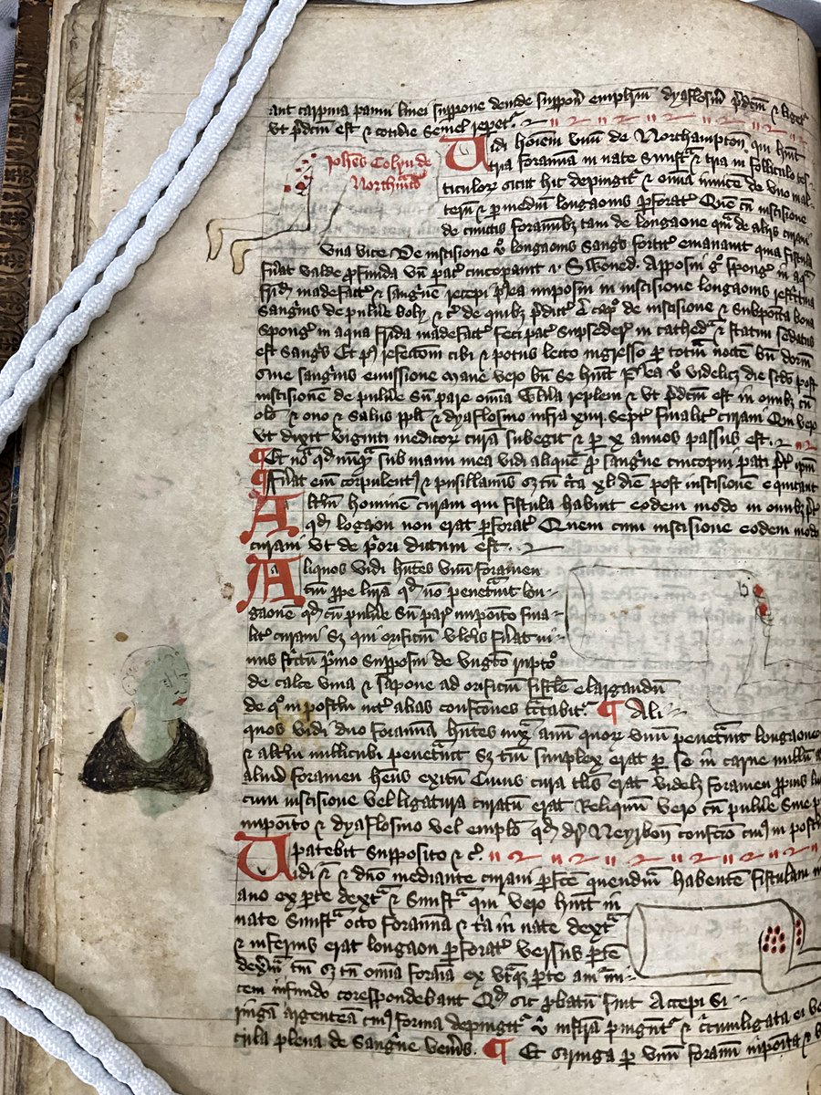 A bit late to the party with our spooky season post, but John of Arderne, the 'Father of Surgery' certainly provided all the gory pictures. MS86