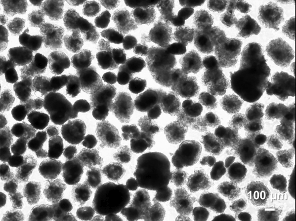 🤔Why?🧐Type 1 #diabetes is a lifechanging, early onset disease (<20 yo). Patients require life-long insulin injections facing risk of complications even with compliance to treatment. Islet replacement therapy is a promising curative form of treatment. 🔗pubmed.ncbi.nlm.nih.gov/32627352/