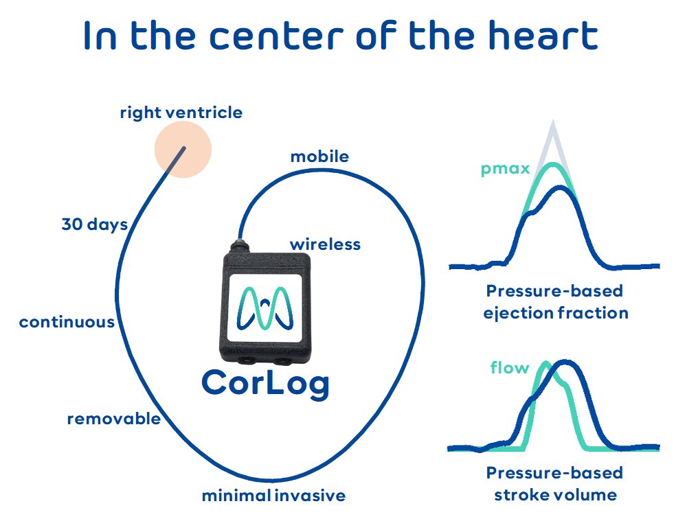 emkamedical's tweet photo. CorLog is an invasive pressure sensor for the right 🩷. Optimize treatment for patients with PH and HF. With novel algorithms, ejection fraction and stroke volume can be calc from pressure curves. 30 d, wireless and mobile, from bed to six-minute 🏃‍♀️test. #CorLog #rightventricle https://t.co/9FqAX0glKx