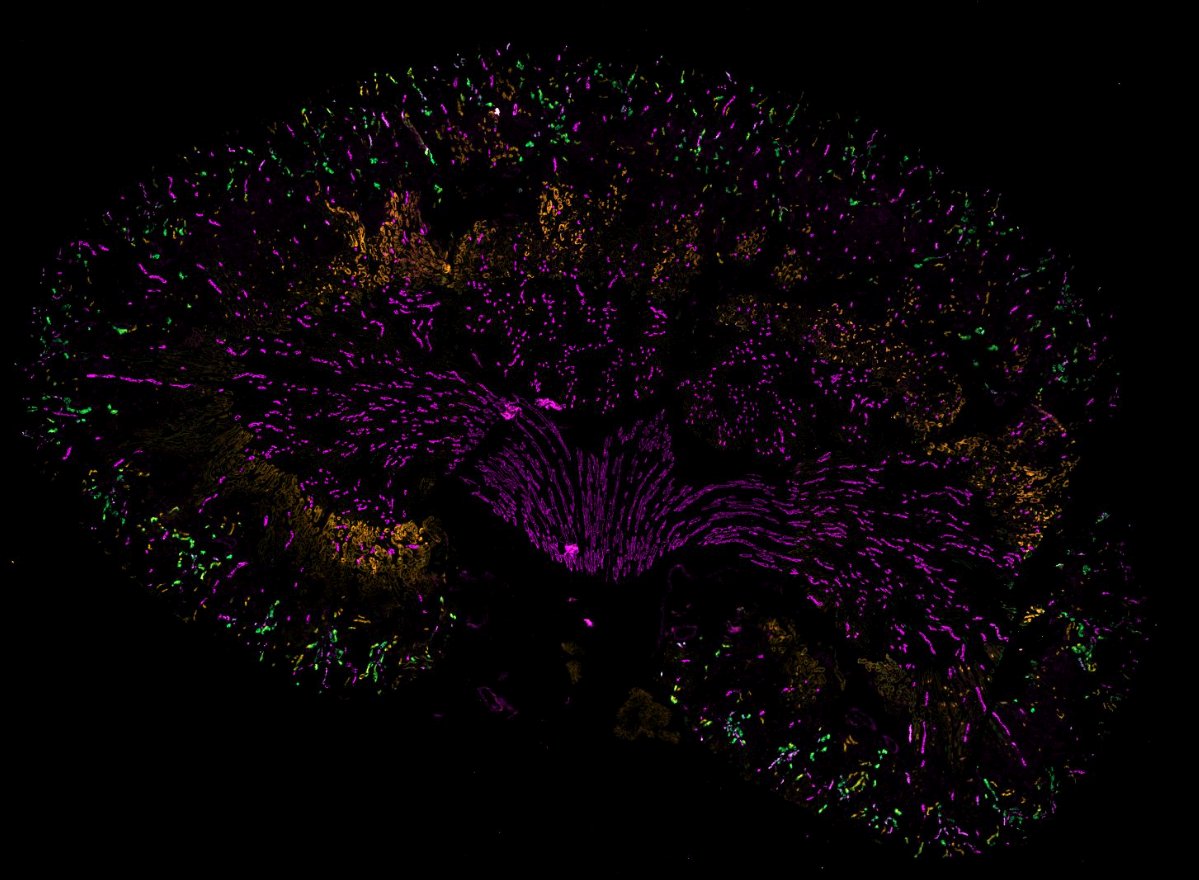 Happy #fluorescencefriday everyone! Beautiful kidney imaged with our #Zeiss AxioObserver.
@SisaLeufert