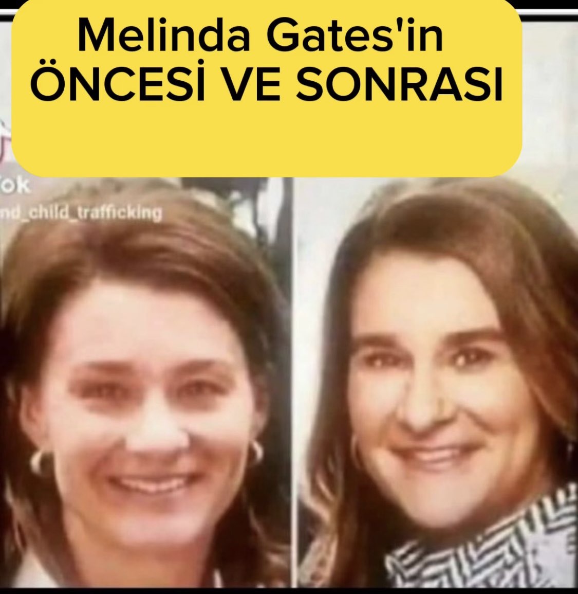cetinlimonboy's tweet photo. Bu bilgiler ve paylaşımlar kendi araştırmalarım ve düşüncelerimi paylaşır. "Komplo Teorisi'dir.

Bill Gates'in yerine "Annie Leibovitz" geçirilmişti.

Melinda Gates'in yerine ise Aktör Kevin Kline geçirildi.

Bu tarikat'ın hikayesi Mısır Firavun'ları ve Babil Soyundan geliyor.
Başlıyoruz ....!
