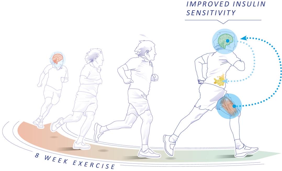 Exercise restores brain insulin sensitivity in sedentary adults who are overweight and obese…
insight.jci.org/articles/view/…