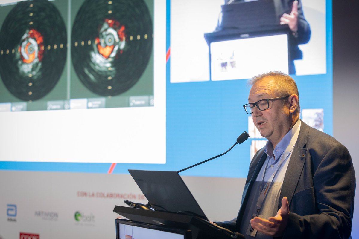 CirEndovascular's tweet photo. 🤔¿Cambiaría el uso de IVUS nuestra estrategia de tratamiento en la revascularizacion de MMII?
El Dr. Javier Martínez @HospitalJaen responde.
#vstrainingvs #vscongress23 https://t.co/4KeZZaSkTU
