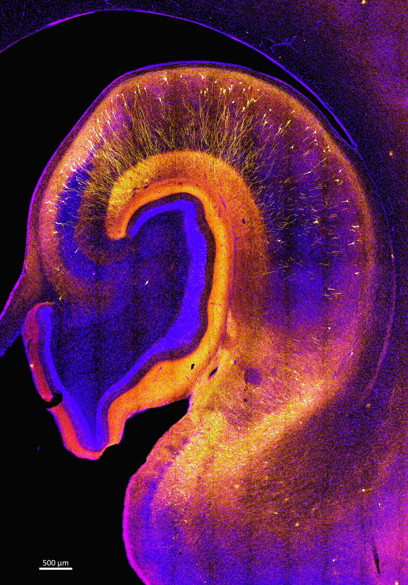 I am on my way to DC for #SfN23, but first, happy #FluorescenceFriday to an amazing community here 🤓🩷! The stitching in this photo is not great, but the misfolded tau propagation in the hippocampus of this early #Alzheimer monkey model is looking quite interesting!